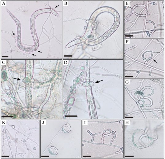 A collage of microscopic images
Description automatically generated