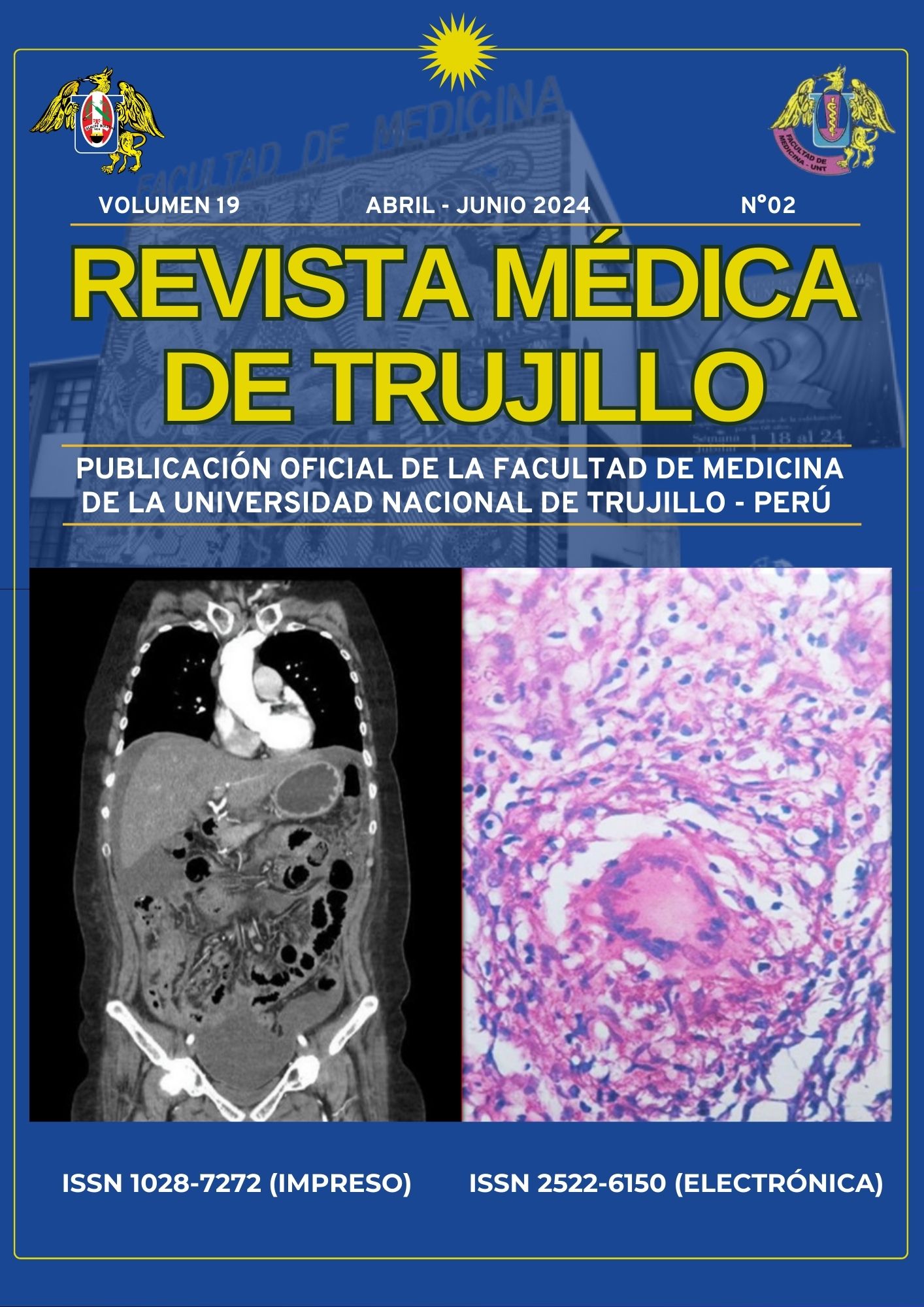 					View Vol. 19 No. 2 (2024): REVISTA MÉDICA DE TRUJILLO
				